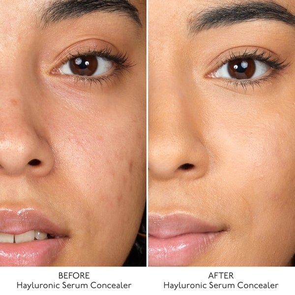 By Terry By Terry Hyaluronic Serum Concealer (Various Shades) Nuova