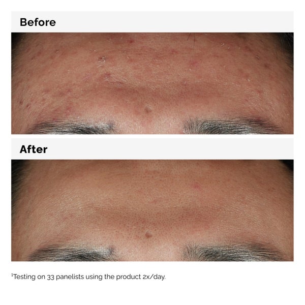 The Ordinary The Ordinary Niacinamide 10% + Zinc 1% Supersize Serum 60ml Prezzo Ridotto
