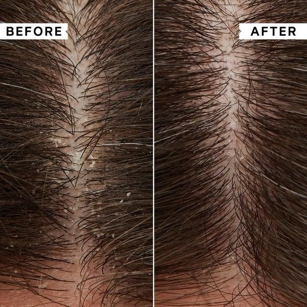 Philip Kingsley Philip Kingsley Flaky Itchy Scalp Shampoo 1000ml - (del valore di £ 88.00) Qualità Garantita