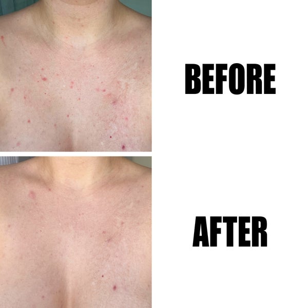 The INKEY List The INKEY List Glycolic Acid Exfoliating Body Stick 45g 2025