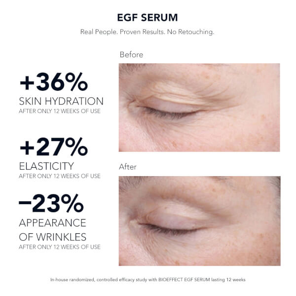 BIOEFFECT BIOEFFECT EGF Serum 15ml Spedizione gratuita