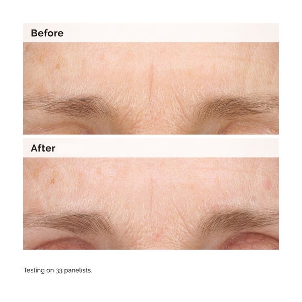 The Ordinary The Ordinary Retinal 0.2% Emulsion 15ml Negozi Online