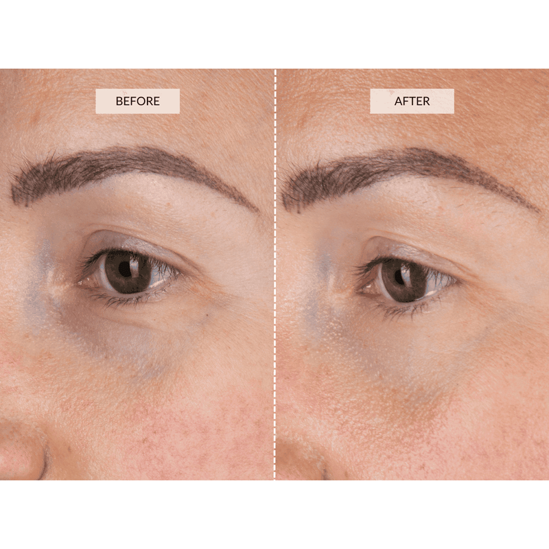 CurrentBody Skin LED Eye Perfector Offerte