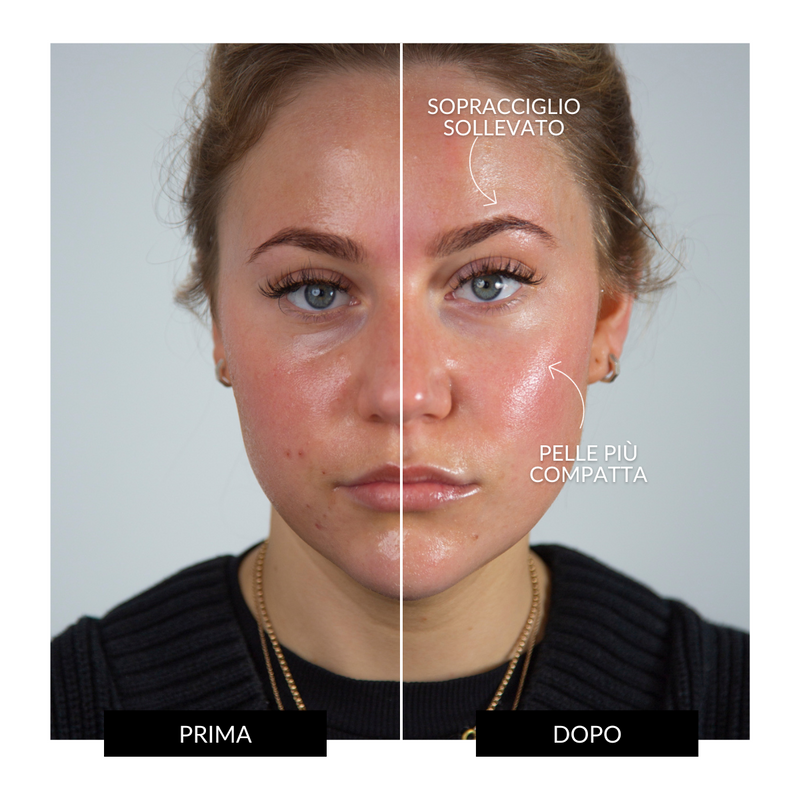 ZIIP Dispositivo Tonificante Viso HALO Saldi Di Fabbrica