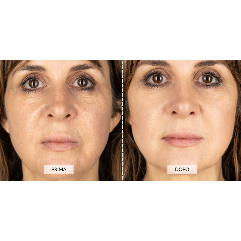 CurrentBody Skin Dispositivo a radiofrequenza per il viso RF Currentbody Skin In Saldo