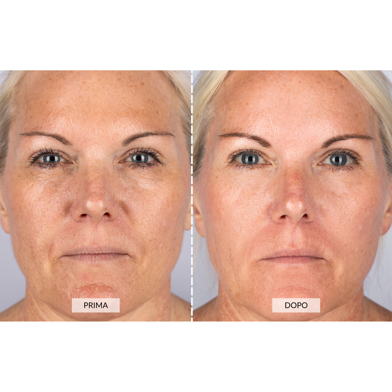 CurrentBody Skin Dispositivo a radiofrequenza per il viso RF Currentbody Skin In Saldo