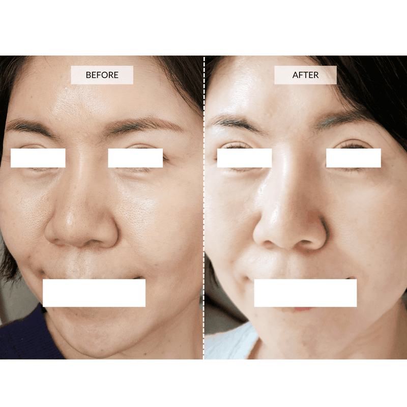 CurrentBody Skin Maschera viso LED 4-in-1 con mappatura a zone Currentbody Skin Italia