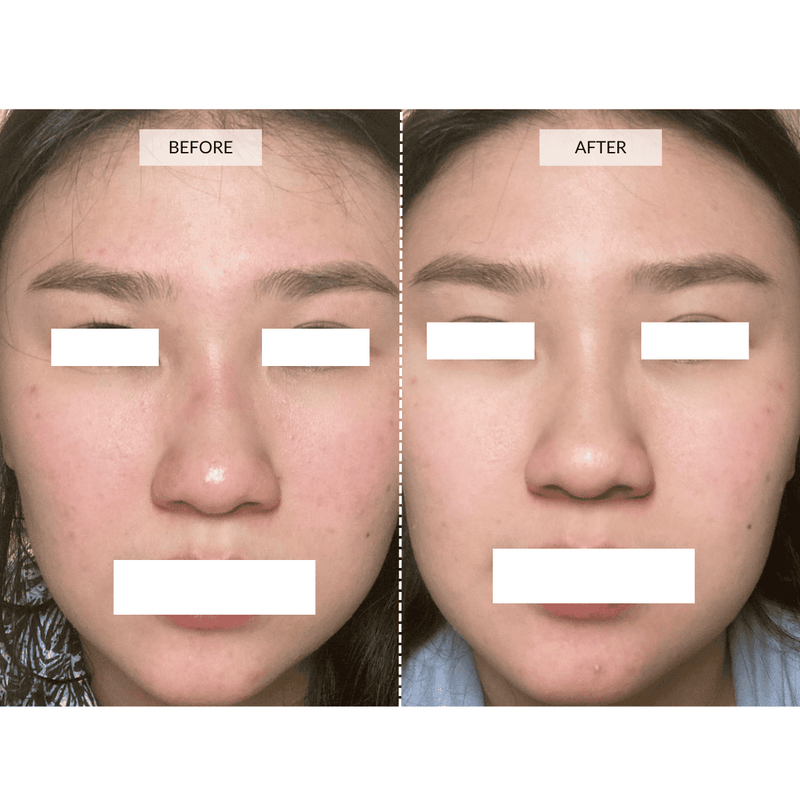 CurrentBody Skin Maschera viso LED 4-in-1 con mappatura a zone Currentbody Skin Italia