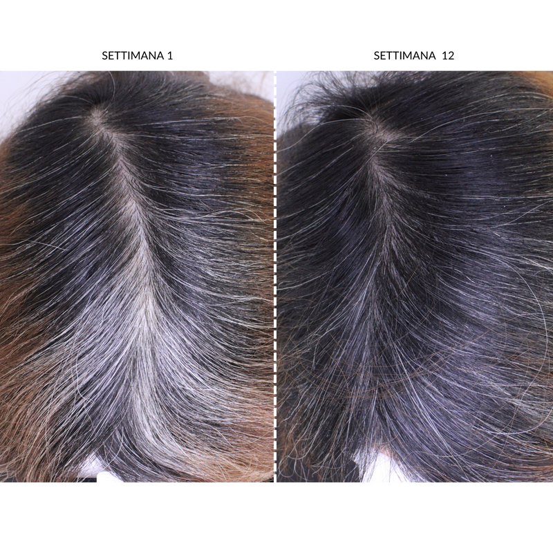 CurrentBody Skin Dispositivo LED Per la Ricrescita dei Capelli In Linea