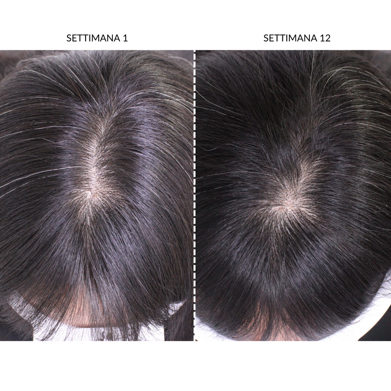 CurrentBody Skin Dispositivo LED Per la Ricrescita dei Capelli In Linea