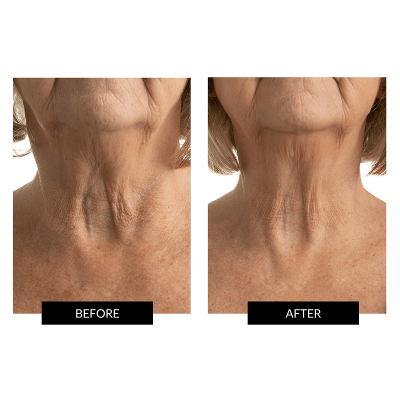 CurrentBody Skin Maschera Collo e Décolleté Qualità