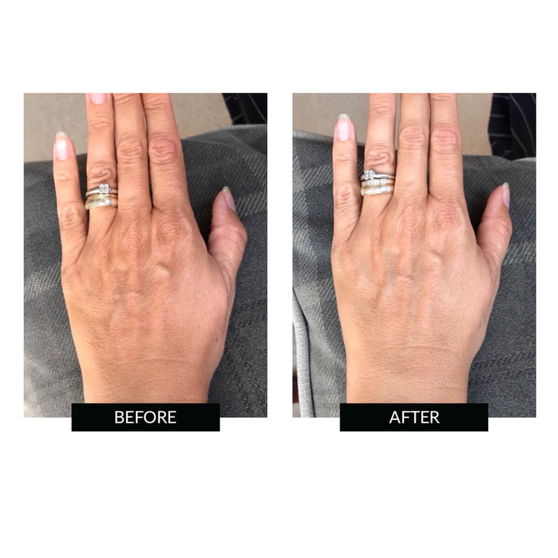 CurrentBody Skin Offers CurrentBody Skin LED Hand Perfector Offerta Acquista Ora