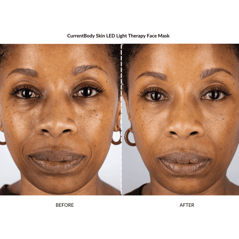 CurrentBody Skin Kit Illuminante e Rimpolpante x ZIIP Offerta natalizia
