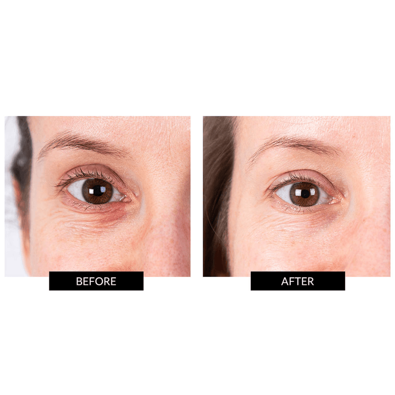 CurrentBody Skin LED Eye Perfector & 5 Eye Hydrogel Masks (del valore di 249€) Presa