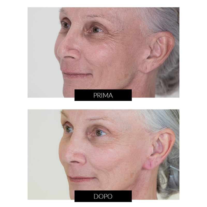 Nira Skin CurrentBody Exclusive Ultimo giorno