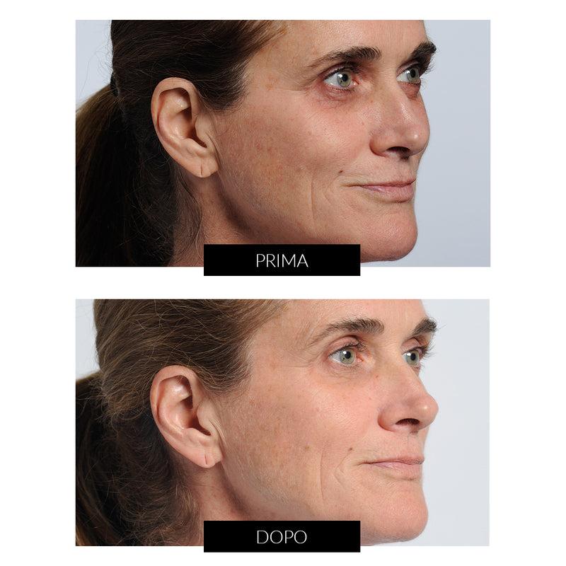 Nira Skin CurrentBody Exclusive Ultimo giorno
