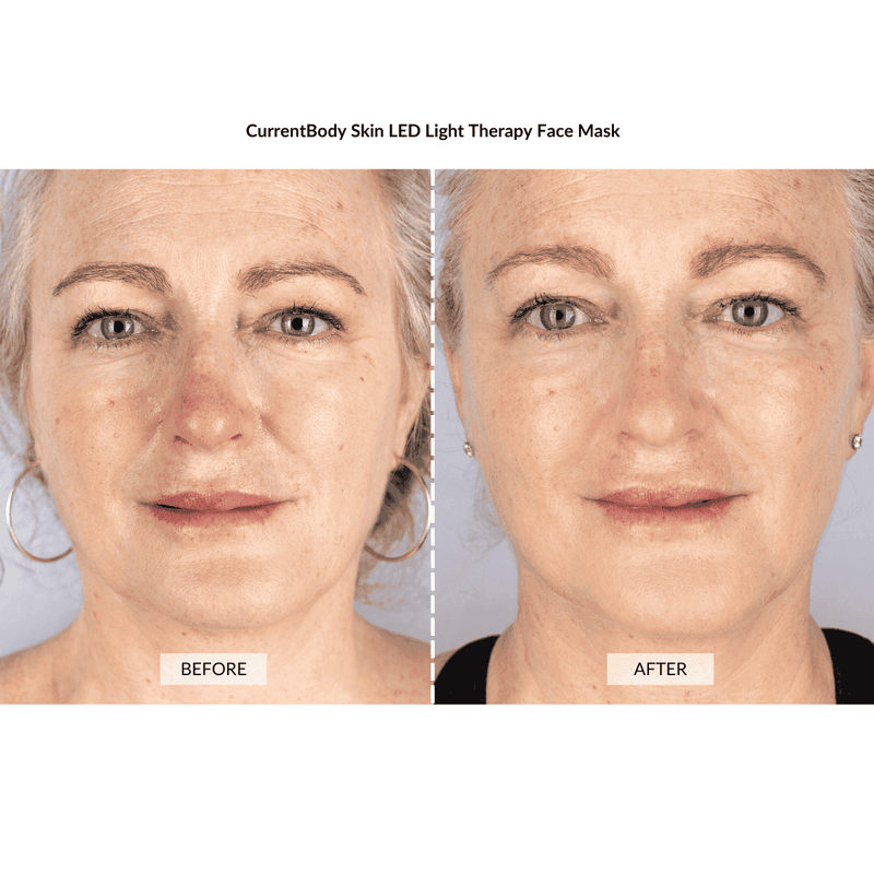 CurrentBody Skin Kit Viso Anti-età completo Vendite Flash