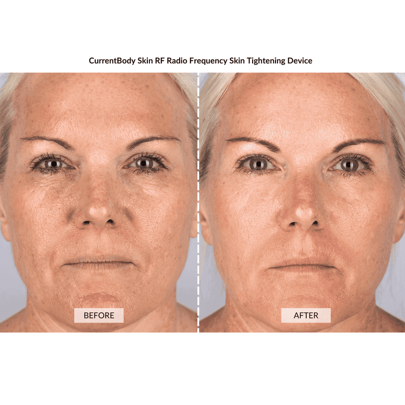 CurrentBody Skin Kit Viso Anti-età completo Vendite Flash