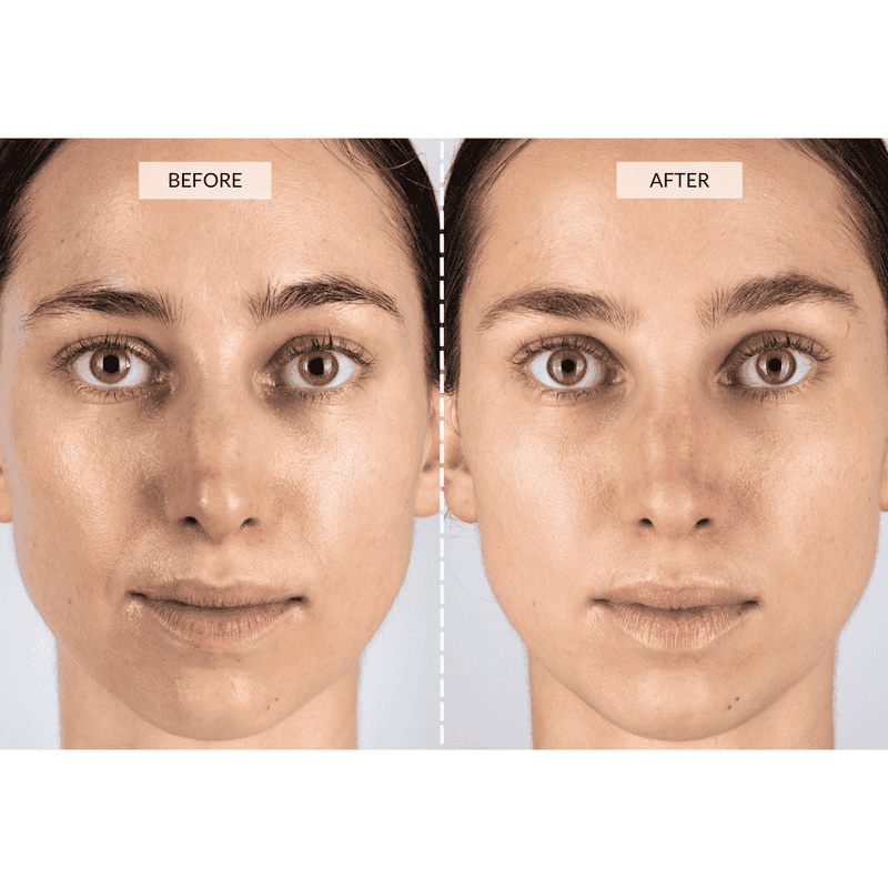 CurrentBody Skin Set Regalo Beauty LED Prezzo Ridotto