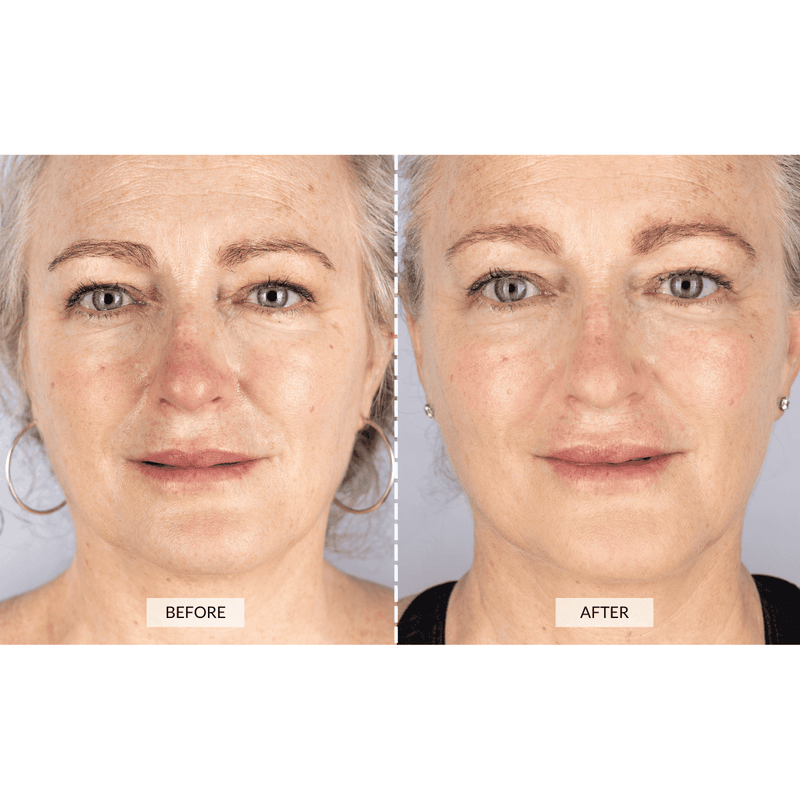 CurrentBody Skin Set Regalo Beauty LED Prezzo Ridotto