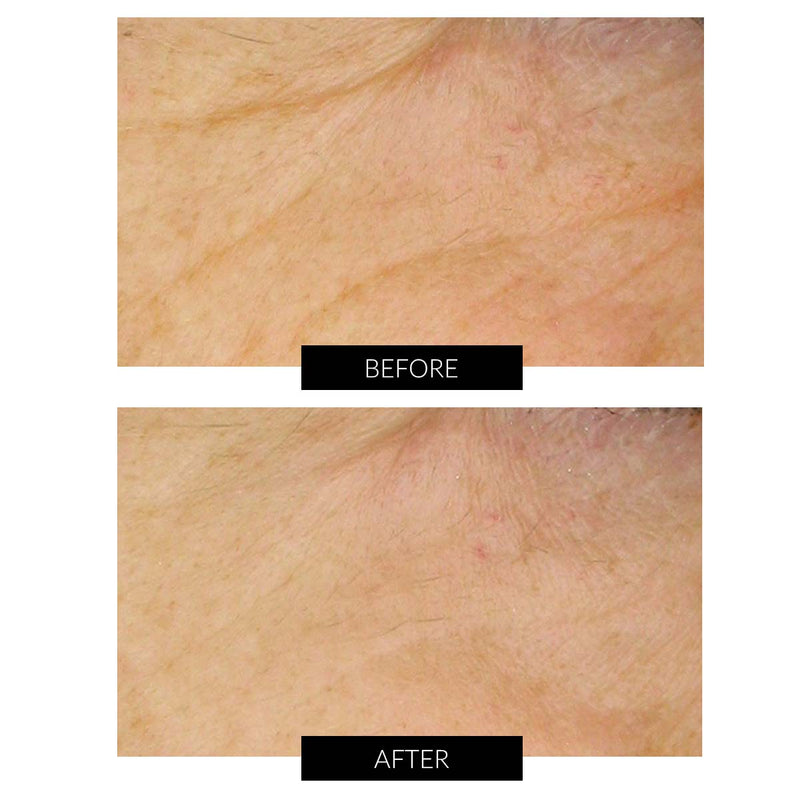 Dr Levy Set Stem Cell Miracle Trial (del valore di 495€) Pezzi Unici