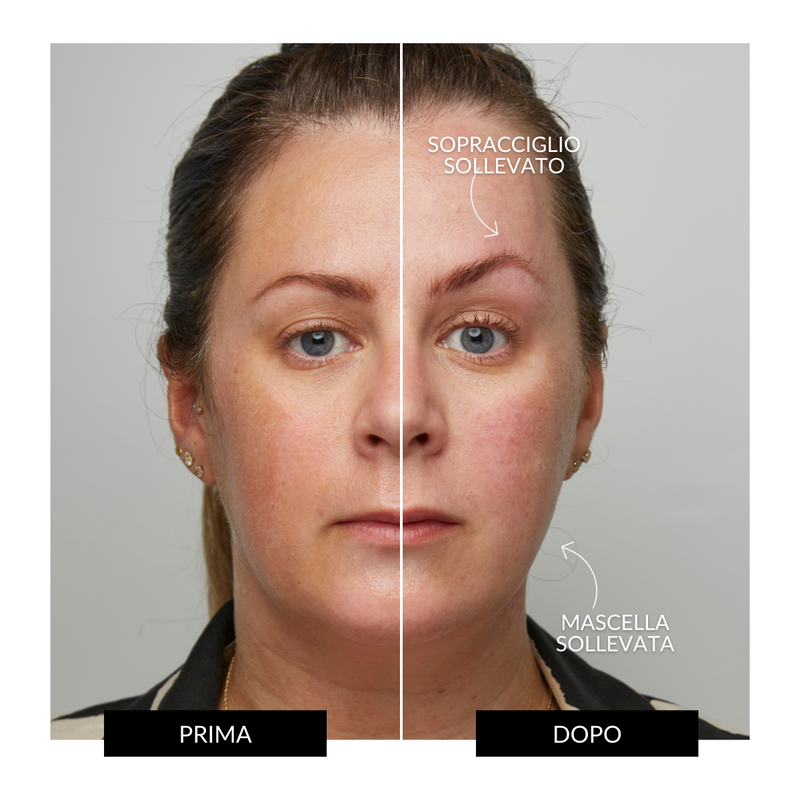 CurrentBody Skin Offers Dispositivo Tonificante Facciale ZIIP HALO Offerta Saldi