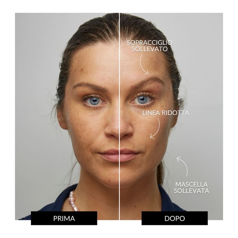 CurrentBody Skin Offers Dispositivo Tonificante Facciale ZIIP HALO Offerta Saldi