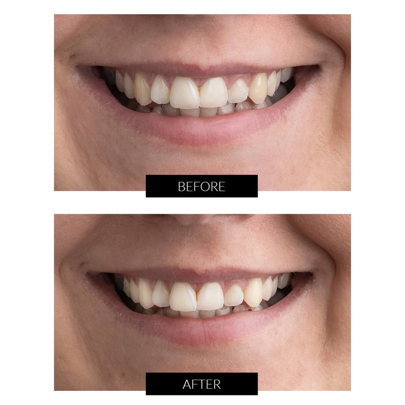 CurrentBody Skin Offers CurrentBody Skin Kit Sbiancamento Denti LED Offerta Fino Al -60%