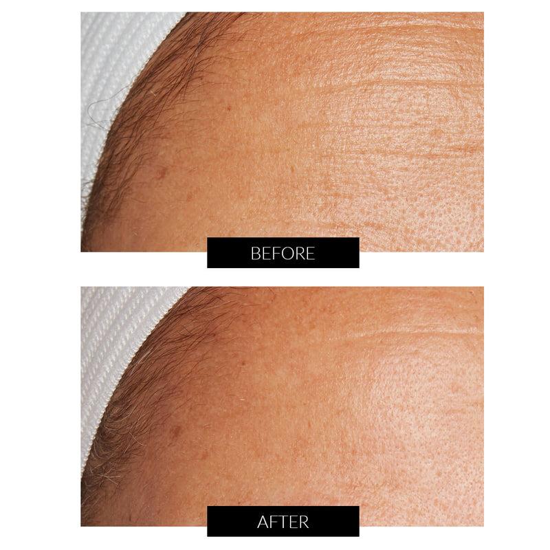Lancer Skincare The Method: Nourish Normal-Combination Skin (50ml) Online