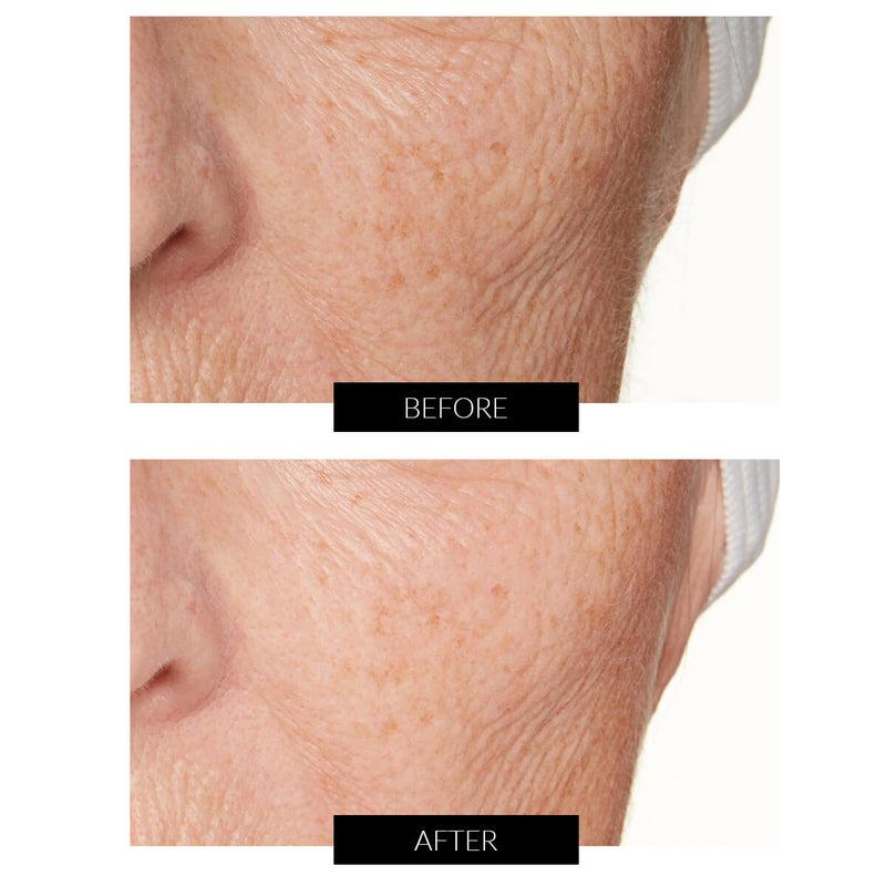 Lancer Skincare The Method: Nourish Normal-Combination Skin (50ml) Online