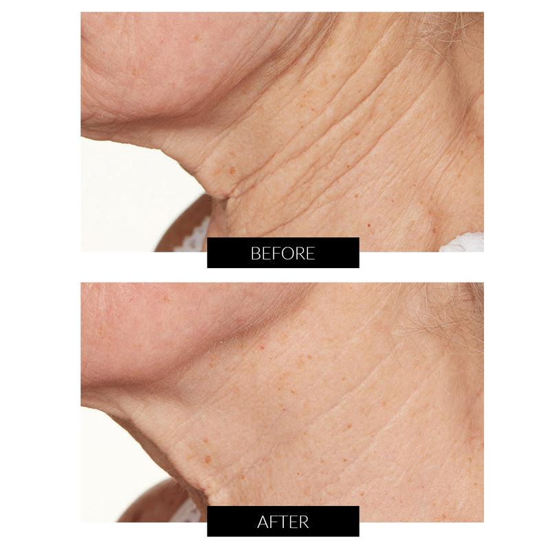 Lancer Skincare Trattamento Notte Intensivo con Hylaplex e Olio di Marula (50ml) Vendite Flash